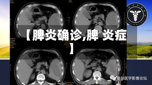【脾炎确诊,脾 炎症】-第2张图片