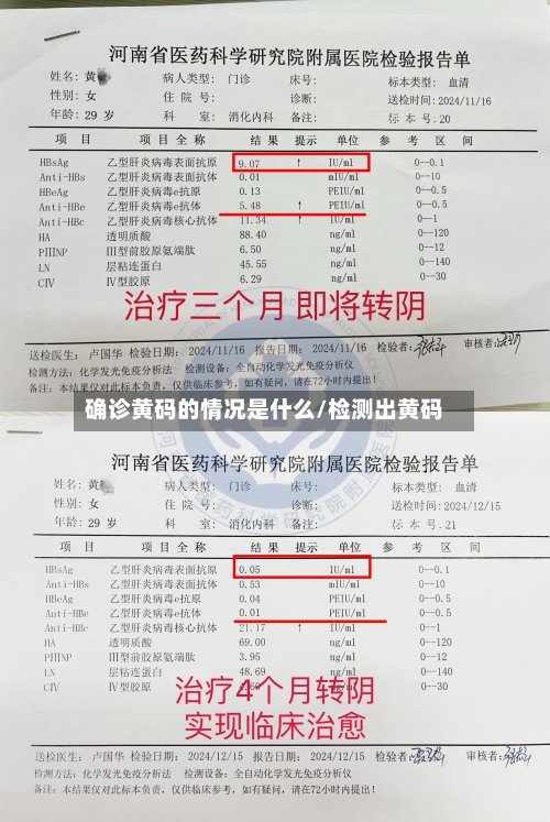 确诊黄码的情况是什么/检测出黄码-第2张图片