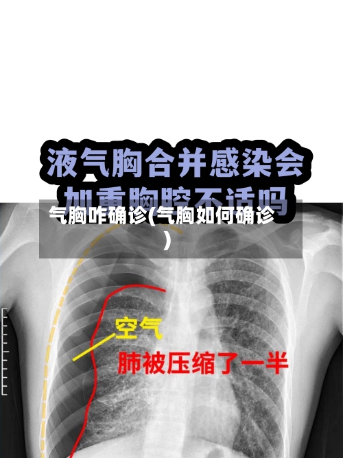 气胸咋确诊(气胸如何确诊)