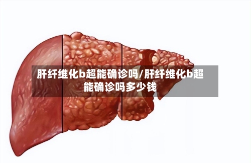 肝纤维化b超能确诊吗/肝纤维化b超能确诊吗多少钱-第2张图片