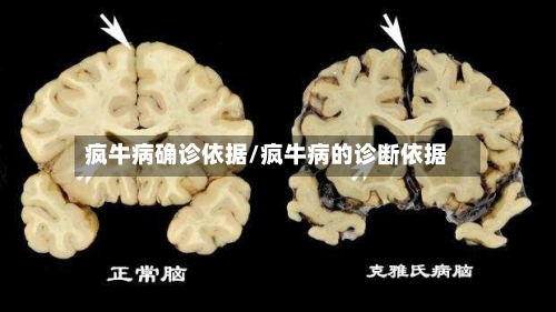 疯牛病确诊依据/疯牛病的诊断依据-第3张图片