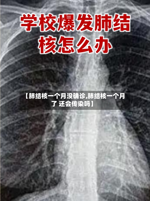 【肺结核一个月没确诊,肺结核一个月了 还会传染吗】-第2张图片