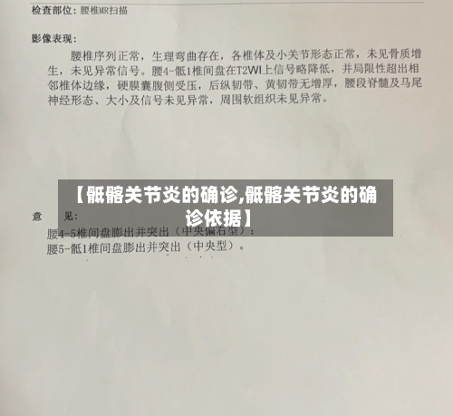 【骶髂关节炎的确诊,骶髂关节炎的确诊依据】-第2张图片