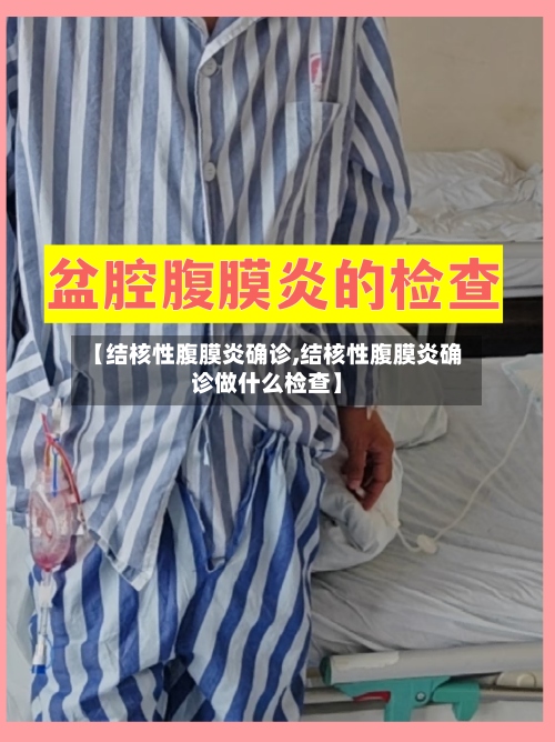 【结核性腹膜炎确诊,结核性腹膜炎确诊做什么检查】-第2张图片