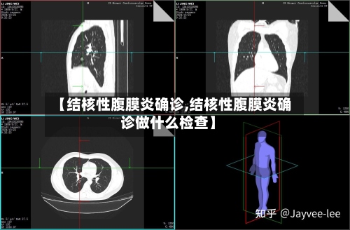 【结核性腹膜炎确诊,结核性腹膜炎确诊做什么检查】-第3张图片