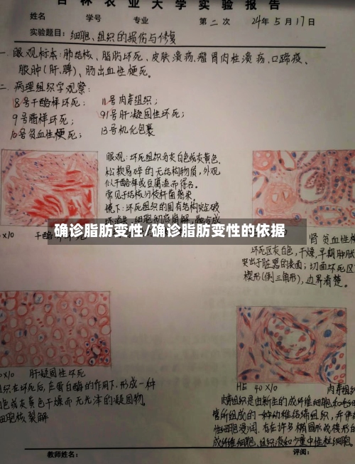 确诊脂肪变性/确诊脂肪变性的依据