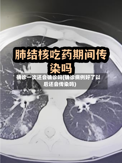 确诊一次还会确诊吗(确诊病例好了以后还会传染吗)-第3张图片