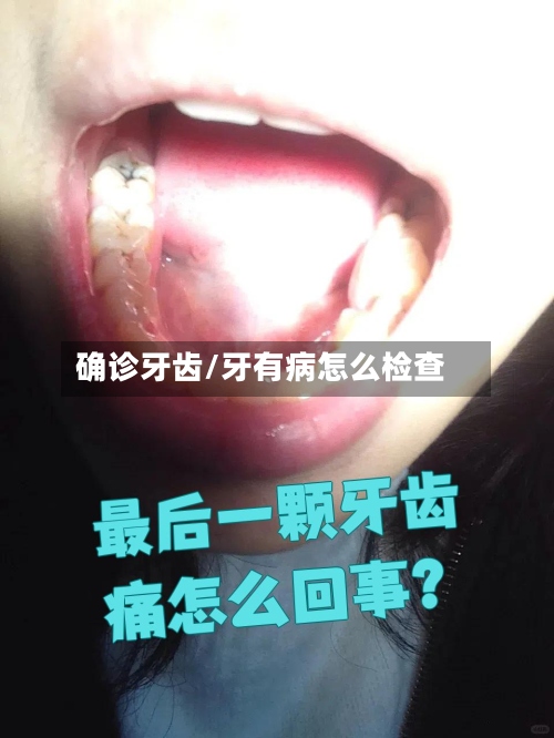 确诊牙齿/牙有病怎么检查-第2张图片
