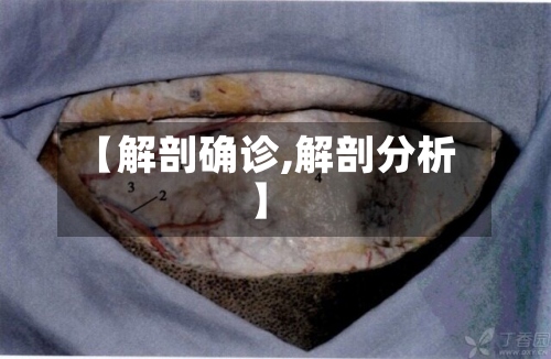 【解剖确诊,解剖分析】