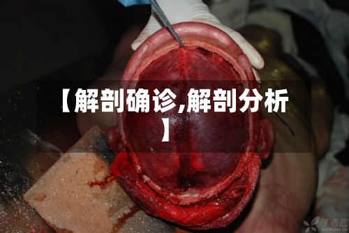 【解剖确诊,解剖分析】-第2张图片