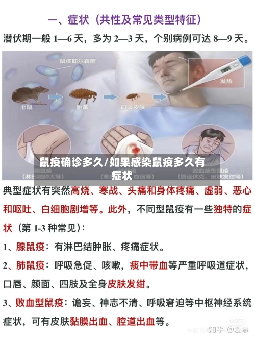 鼠疫确诊多久/如果感染鼠疫多久有症状-第2张图片