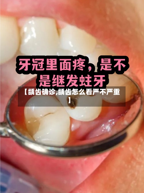 【龋齿确诊,龋齿怎么看严不严重】