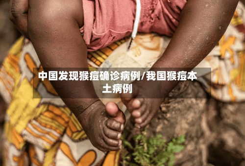 中国发现猴痘确诊病例/我国猴痘本土病例