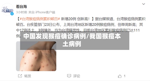 中国发现猴痘确诊病例/我国猴痘本土病例-第3张图片