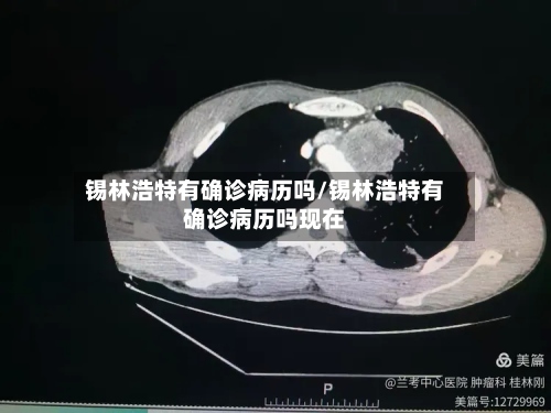锡林浩特有确诊病历吗/锡林浩特有确诊病历吗现在