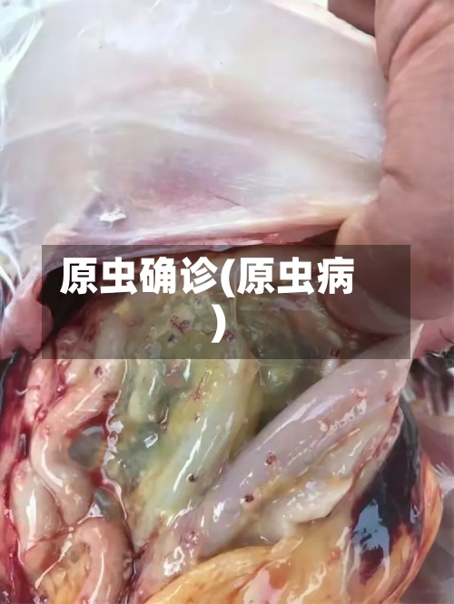 原虫确诊(原虫病)-第2张图片