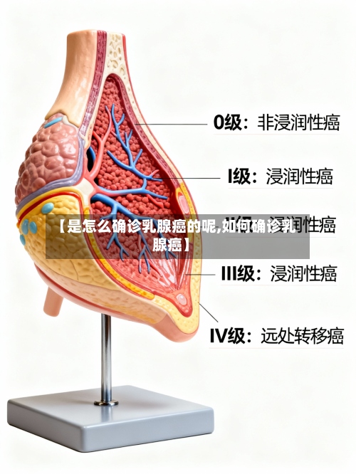 【是怎么确诊乳腺癌的呢,如何确诊乳腺癌】