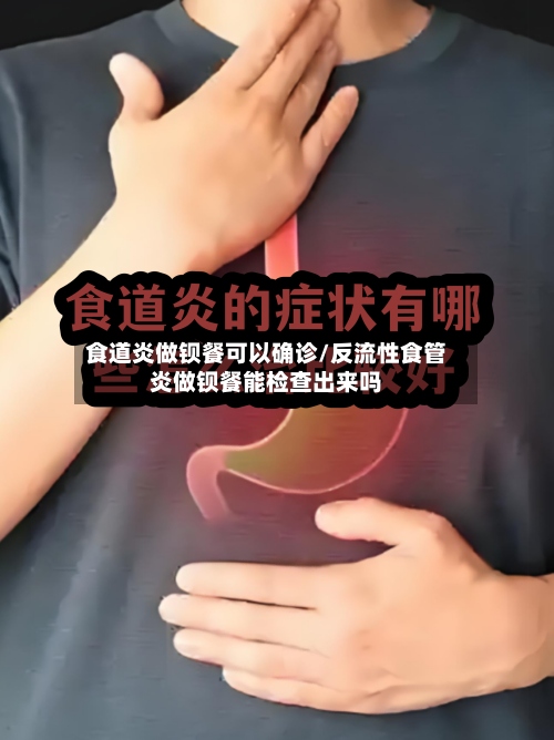 食道炎做钡餐可以确诊/反流性食管炎做钡餐能检查出来吗-第3张图片