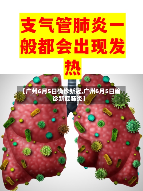 【广州6月5日确诊新冠,广州6月5日确诊新冠肺炎】