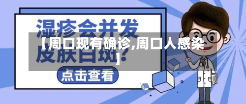 【周口现有确诊,周口人感染】-第2张图片