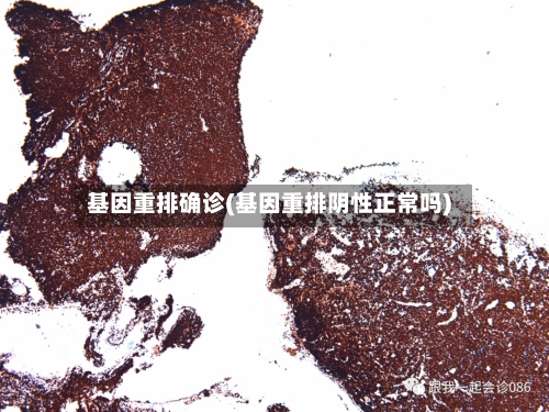 基因重排确诊(基因重排阴性正常吗)-第2张图片