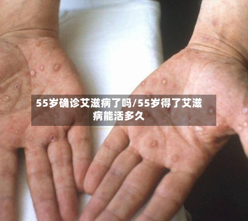 55岁确诊艾滋病了吗/55岁得了艾滋病能活多久-第2张图片