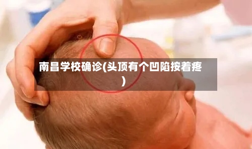 南昌学校确诊(头顶有个凹陷按着疼)-第2张图片