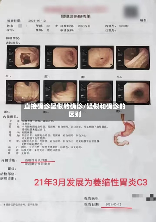 直接确诊疑似转确诊/疑似和确诊的区别-第3张图片
