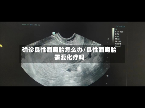 确诊良性葡萄胎怎么办/良性葡萄胎需要化疗吗-第3张图片