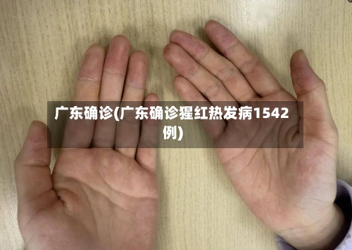 广东确诊(广东确诊猩红热发病1542例)-第2张图片