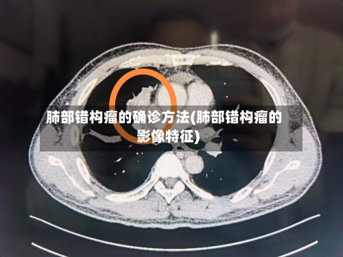 肺部错构瘤的确诊方法(肺部错构瘤的影像特征)