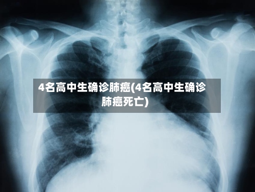 4名高中生确诊肺癌(4名高中生确诊肺癌死亡)-第2张图片