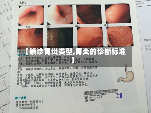 【确诊胃炎类型,胃炎的诊断标准】-第2张图片