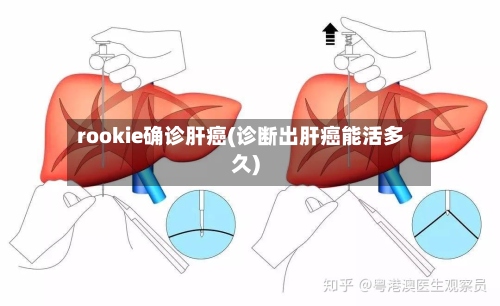 rookie确诊肝癌(诊断出肝癌能活多久)
