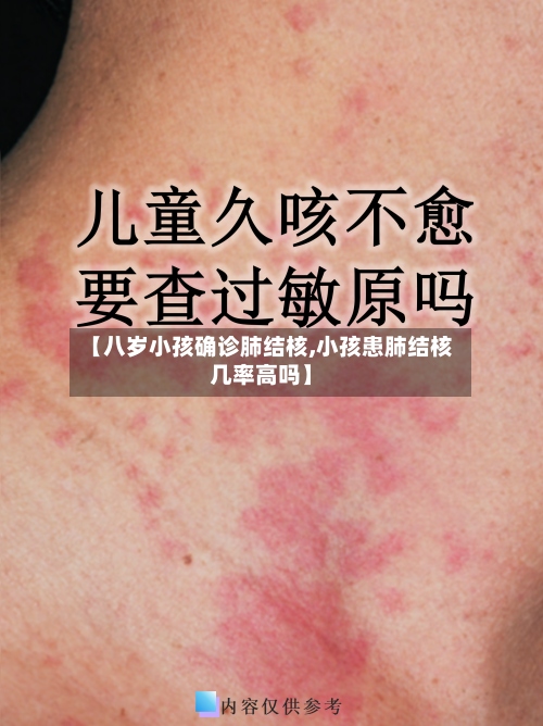 【八岁小孩确诊肺结核,小孩患肺结核几率高吗】-第2张图片
