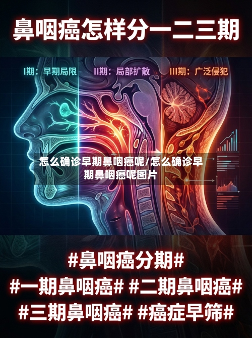 怎么确诊早期鼻咽癌呢/怎么确诊早期鼻咽癌呢图片