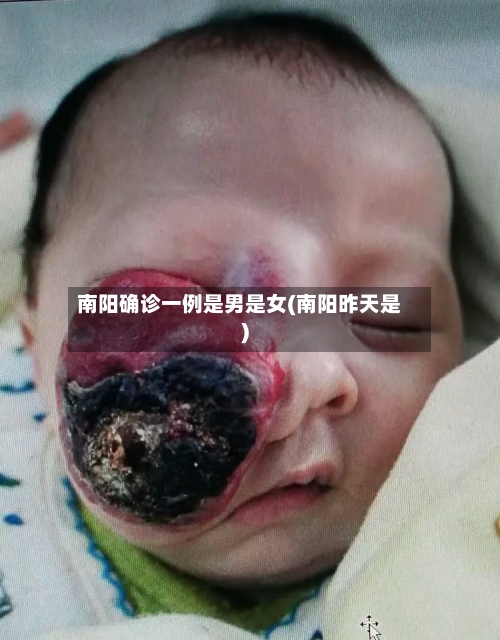 南阳确诊一例是男是女(南阳昨天是)