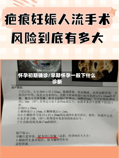怀孕初期确诊/早期怀孕一般下什么诊断-第2张图片