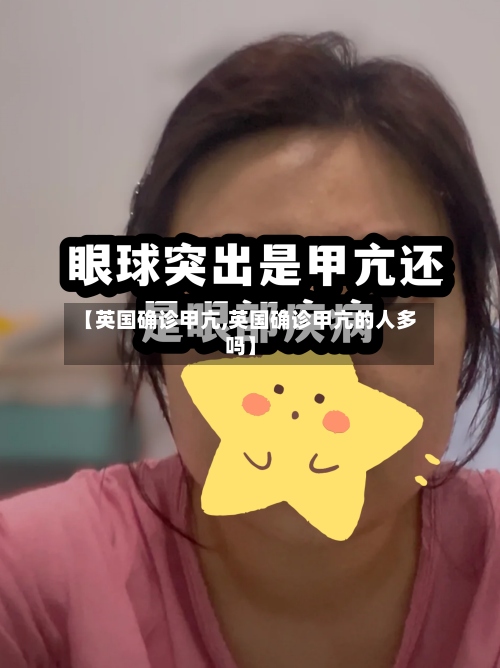 【英国确诊甲亢,英国确诊甲亢的人多吗】