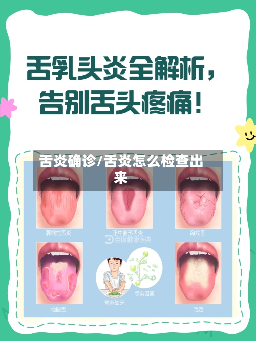 舌炎确诊/舌炎怎么检查出来-第2张图片