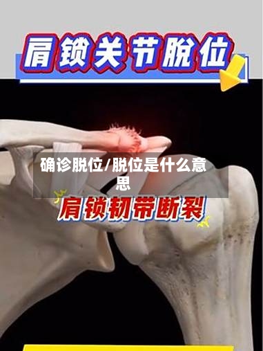 确诊脱位/脱位是什么意思-第2张图片