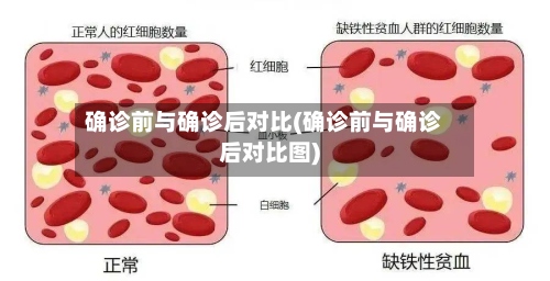 确诊前与确诊后对比(确诊前与确诊后对比图)-第3张图片