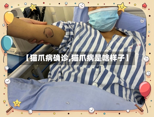 【猫爪病确诊,猫爪病是啥样子】