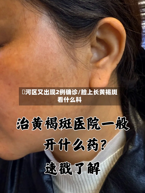瀍河区又出现2例确诊/脸上长黄褐斑看什么科-第3张图片