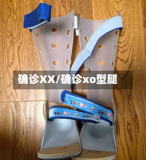 确诊XX/确诊xo型腿