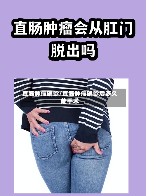 直肠肿瘤确诊/直肠肿瘤确诊后多久能手术-第2张图片