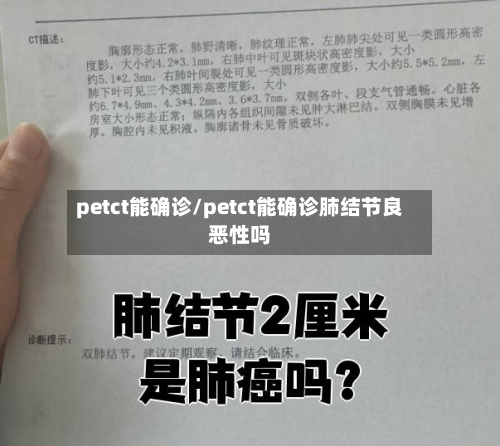 petct能确诊/petct能确诊肺结节良恶性吗-第2张图片