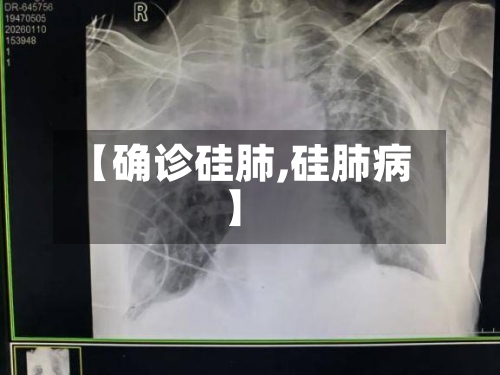 【确诊硅肺,硅肺病】-第2张图片
