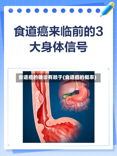 食道癌的确诊有赖于(食道癌的概率)-第2张图片