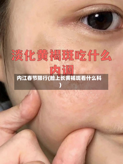 内江春节限行(脸上长黄褐斑看什么科)